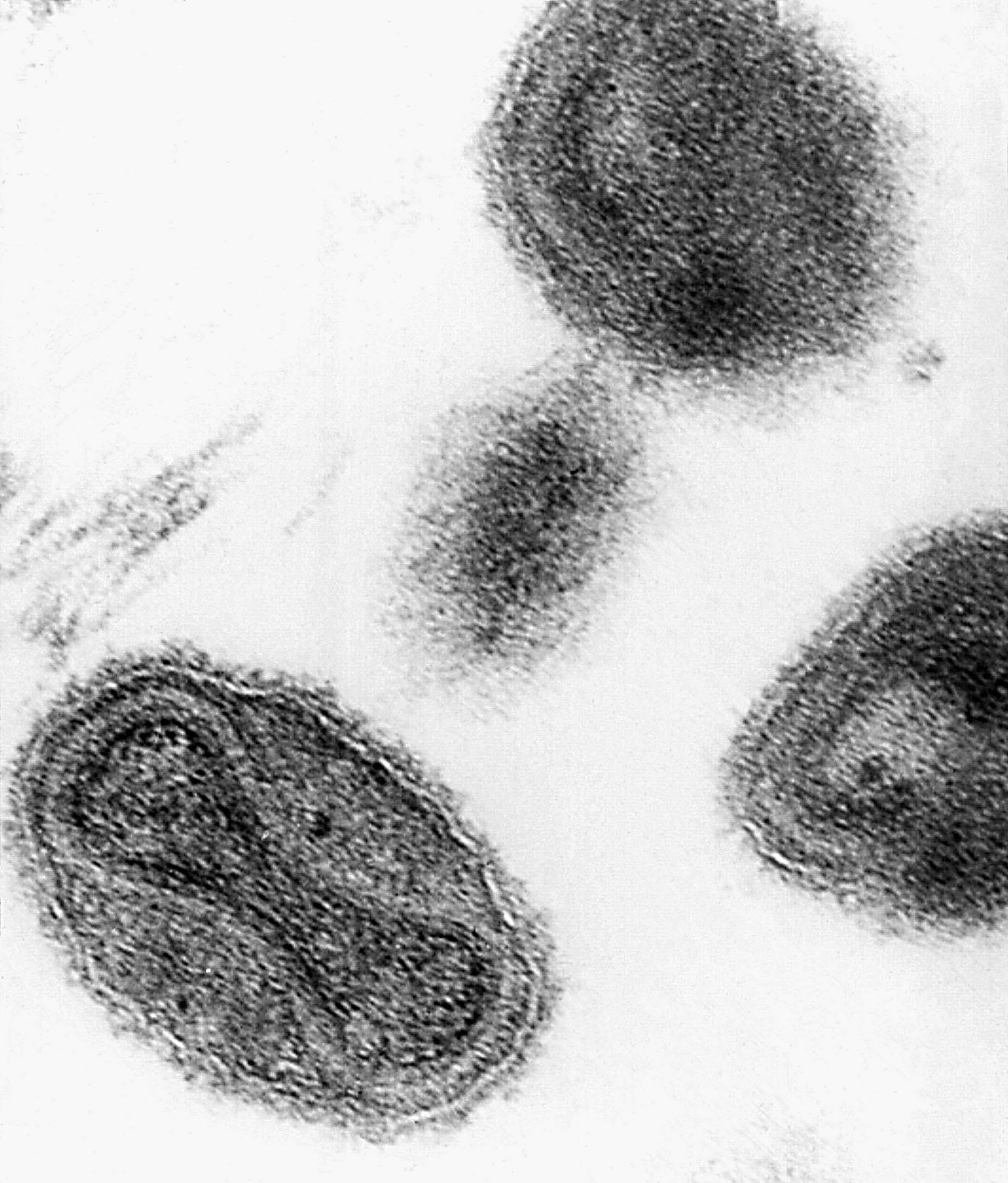 Scientists Urge Delay In Destroying Last Smallpox - TPM – Talking ...