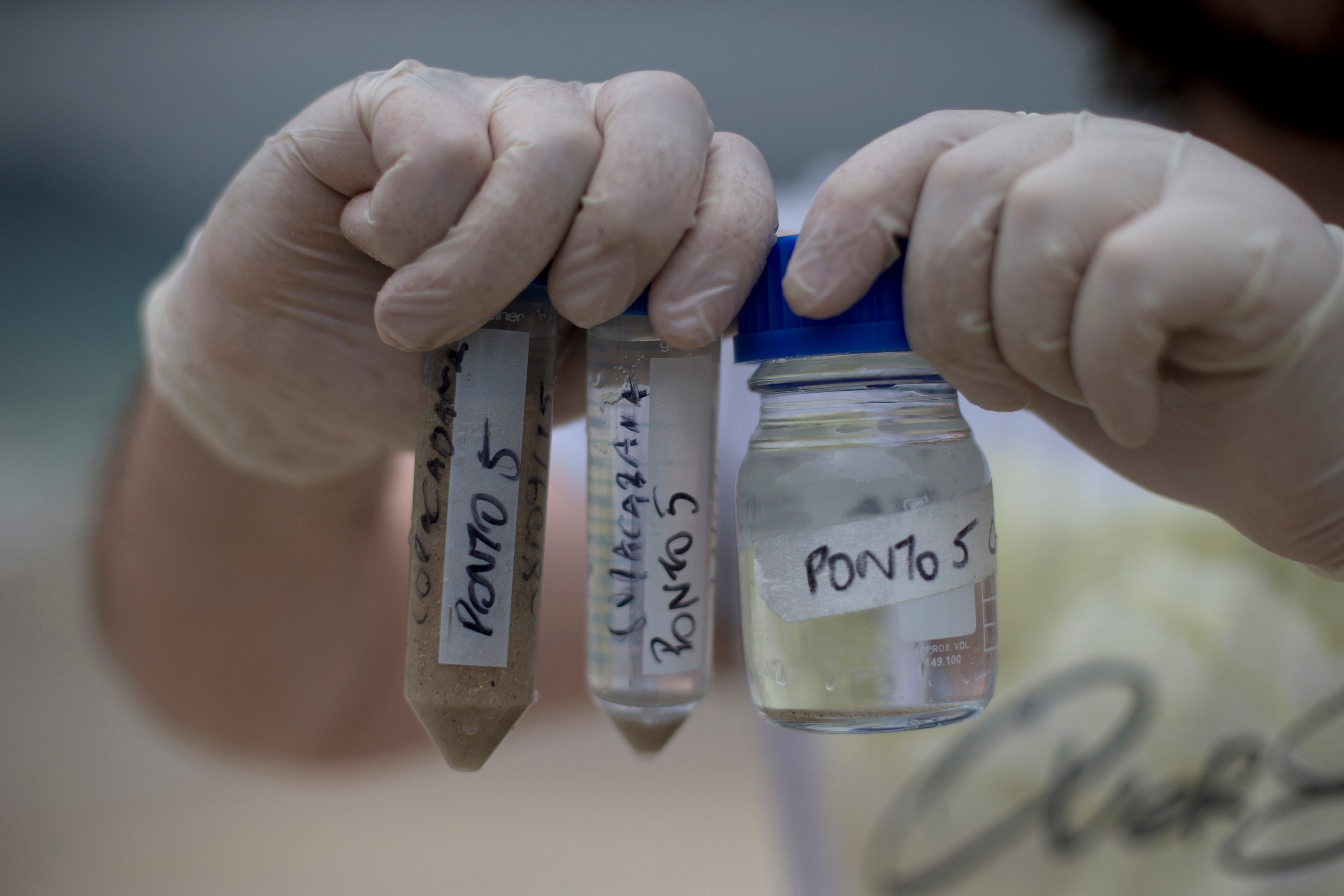 AP Test Shows Rio Olympic Water Badly Polluted Far Offshore: ‘Exposure ...