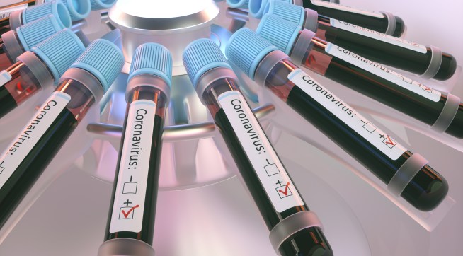 Coronaviruses research, conceptual illustration. Vials of blood in a centrifuge being tested for coronavirus infection.
