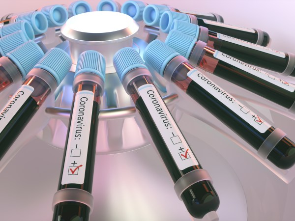 Coronaviruses research, conceptual illustration. Vials of blood in a centrifuge being tested for coronavirus infection.
