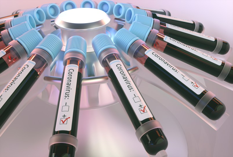 Coronaviruses research, conceptual illustration. Vials of blood in a centrifuge being tested for coronavirus infection.